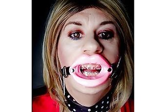 Open mouth lip gag and braces fetish featuring Alexandra Braces